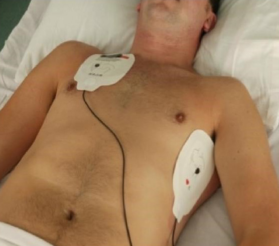 Defibrillator pad position